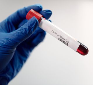 Person Holding a Covid-19 Blood Test